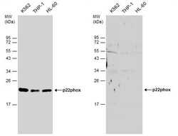 Invitrogen CYBA Polyclonal Antibody 100 &mu;L | Buy Online | Invitrogen&trade; | Fisher Scientific