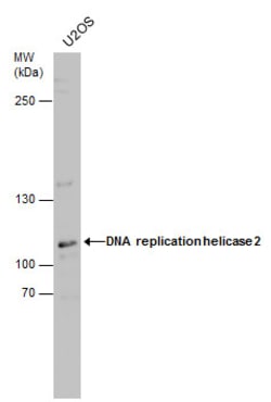 Invitrogen DNA2 Polyclonal Antibody 100 &mu;L; Unconjugated:Antibodies,