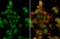 Invitrogen DNMT3A Polyclonal Antibody 100 &mu;L; Unconjugated:Antibodies,