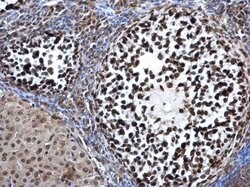 Invitrogen DNMT3A Polyclonal Antibody 100 &mu;L; Unconjugated:Antibodies,