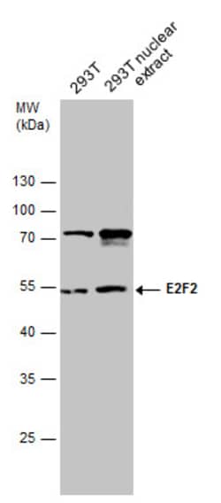 Invitrogen E2F2 Polyclonal Antibody 100 &mu;L; Unconjugated:Antibodies,