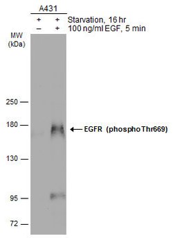 Invitrogen Phospho-EGFR (Thr669) Polyclonal Antibody 100 &mu;L; Unconjugated:Antibodies,