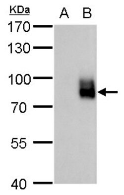 Invitrogen EGR1 Polyclonal Antibody 100 &mu;L | Buy Online | Invitrogen&trade; | Fisher Scientific
