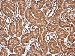 Invitrogen eIF4E Polyclonal Antibody 100 &mu;L; Unconjugated:Antibodies,