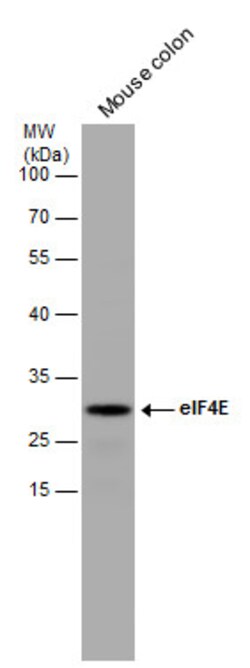 Invitrogen eIF4E Polyclonal Antibody 100 &mu;L; Unconjugated:Antibodies,