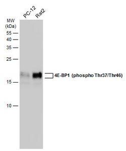 Invitrogen Phospho-4EBP1 (Thr37, Thr46) Polyclonal Antibody 100 &mu;L;