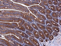 Invitrogen EPRS Polyclonal Antibody 100 &mu;L; Unconjugated:Antibodies,