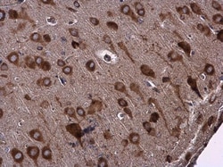Invitrogen EPRS Polyclonal Antibody 100 &mu;L; Unconjugated:Antibodies,