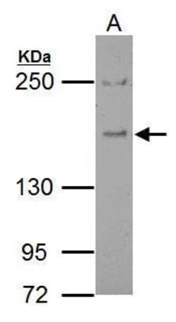 Invitrogen EPS15 Polyclonal Antibody 100 &mu;L; Unconjugated:Antibodies,