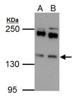 Invitrogen EPS15 Polyclonal Antibody 100 &mu;L; Unconjugated:Antibodies,