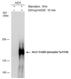 Invitrogen Phospho-ErbB2 (HER-2) (Tyr1139) Polyclonal Antibody 100 &mu;L;