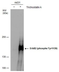 Invitrogen Phospho-ErbB2 (HER-2) (Tyr1139) Polyclonal Antibody 100 &mu;L;
