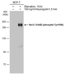 Invitrogen Phospho-ErbB2 (HER-2) (Tyr1196) Polyclonal Antibody 100 &mu;L;