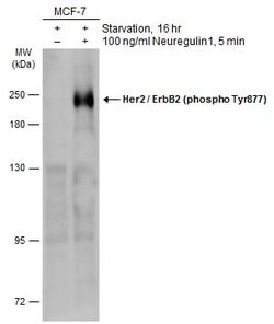 Phospho-ErbB2 (HER-2) (Tyr877) Polyclonal Antibody, Invitrogen 100 &mu;L;