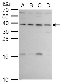 Invitrogen ERCC1 Polyclonal Antibody 100 &mu;L; Unconjugated:Antibodies,
