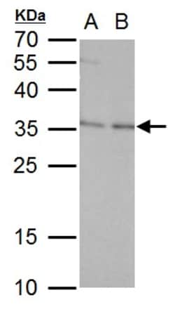 Invitrogen ERCC1 Polyclonal Antibody 100 &mu;L; Unconjugated:Antibodies,
