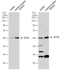 Invitrogen ETS1 Polyclonal Antibody 100 &mu;L | Buy Online | Invitrogen&trade; | Fisher Scientific