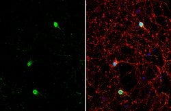 Invitrogen ETV1 Polyclonal Antibody 100 &mu;L; Unconjugated:Antibodies,