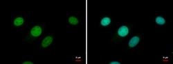Invitrogen ETV1 Polyclonal Antibody 100 &mu;L; Unconjugated:Antibodies,