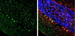 Invitrogen ETV1 Polyclonal Antibody 100 &mu;L; Unconjugated:Antibodies,
