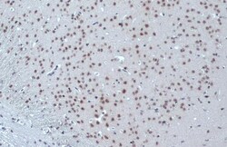 Invitrogen ETV1 Polyclonal Antibody 100 &mu;L; Unconjugated:Antibodies,