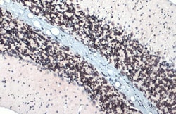 Invitrogen ETV1 Polyclonal Antibody 100 &mu;L; Unconjugated:Antibodies,