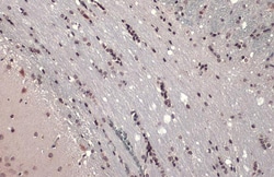 Invitrogen ETV1 Polyclonal Antibody 100 &mu;L; Unconjugated:Antibodies,