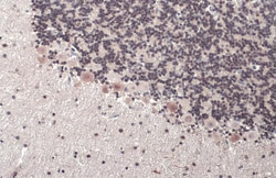 Invitrogen ETV1 Polyclonal Antibody 100 &mu;L; Unconjugated:Antibodies,