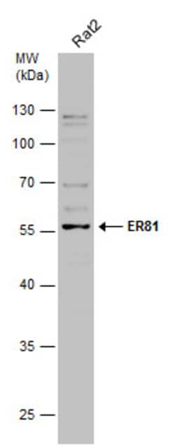 Invitrogen ETV1 Polyclonal Antibody 100 &mu;L; Unconjugated:Antibodies,