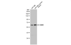 Invitrogen ETV1 Polyclonal Antibody 100 &mu;L; Unconjugated:Antibodies,