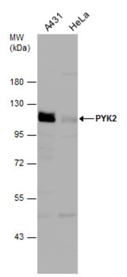 Invitrogen PYK2 Polyclonal Antibody 100 &mu;L; Unconjugated:Antibodies,