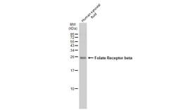 Invitrogen FOLR2 Polyclonal Antibody 100 &mu;L | Buy Online | Invitrogen&trade; | Fisher Scientific