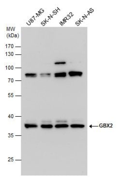 Invitrogen GBX2 Polyclonal Antibody 100 &mu;L; Unconjugated:Antibodies,