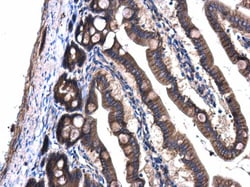 Invitrogen GNAQ Polyclonal Antibody 100 &mu;L; Unconjugated:Antibodies,