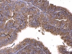 Invitrogen GNAQ Polyclonal Antibody 100 &mu;L; Unconjugated:Antibodies,