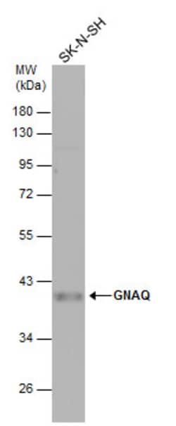 Invitrogen GNAQ Polyclonal Antibody 100 &mu;L; Unconjugated:Antibodies,