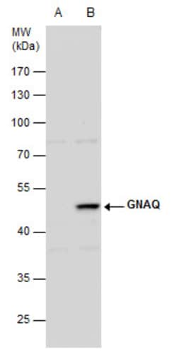 Invitrogen GNAQ Polyclonal Antibody 100 &mu;L; Unconjugated:Antibodies,