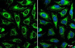 Invitrogen GOT2 Polyclonal Antibody 100 &mu;L; Unconjugated:Antibodies,