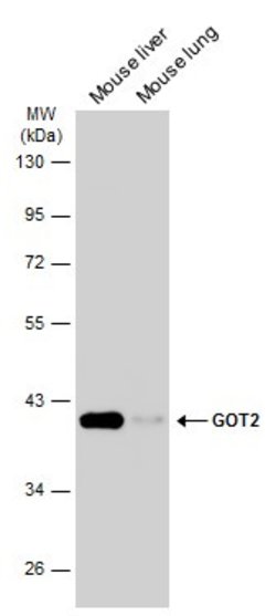 Invitrogen GOT2 Polyclonal Antibody 100 &mu;L; Unconjugated:Antibodies,
