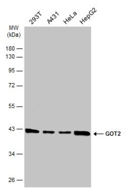 Invitrogen GOT2 Polyclonal Antibody 100 &mu;L; Unconjugated:Antibodies,