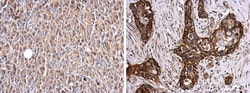Invitrogen Glypican 1 Polyclonal Antibody 100 &mu;L | Buy Online | Invitrogen&trade; | Fisher Scientific