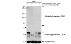 Invitrogen Glypican 1 Polyclonal Antibody 100 &mu;L | Buy Online | Invitrogen&trade; | Fisher Scientific