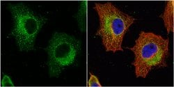 Invitrogen GSTP1 Polyclonal Antibody 100 &mu;L; Unconjugated:Antibodies,