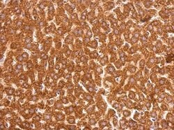 Invitrogen GSTP1 Polyclonal Antibody 100 &mu;L; Unconjugated:Antibodies,