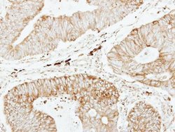 Invitrogen GSTP1 Polyclonal Antibody 100 &mu;L; Unconjugated:Antibodies,