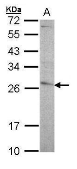 Invitrogen GSTP1 Polyclonal Antibody 100 &mu;L; Unconjugated:Antibodies,
