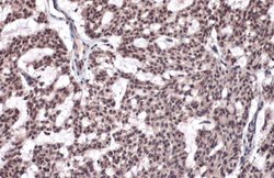 Invitrogen Phospho-Histone H2A.X (Ser139) Polyclonal Antibody 100 &mu;L;