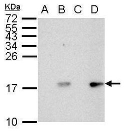 Invitrogen Phospho-Histone H2A.X (Ser139) Polyclonal Antibody 100 &mu;L;