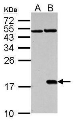 Invitrogen Phospho-Histone H2A.X (Ser139) Polyclonal Antibody 100 &mu;L;