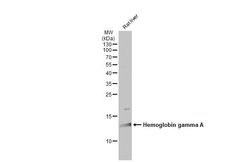 Invitrogen Hemoglobin gamma A Polyclonal Antibody 100 &mu;L; Unconjugated:Antibodies,